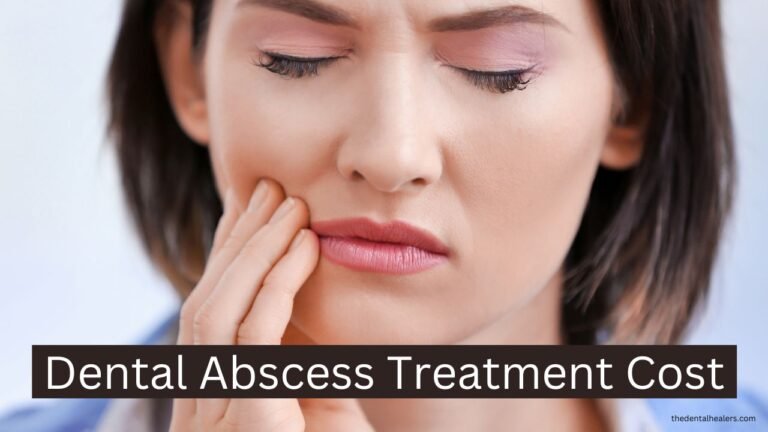 Dental Abscess Treatment Cost