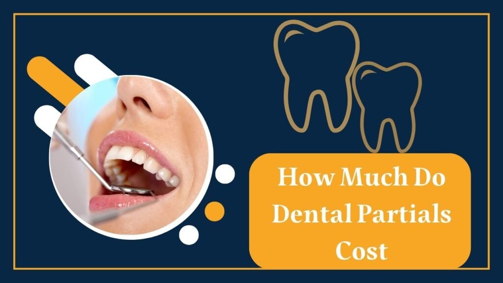 How Much Do Dental Partials Cost 1 How Much Do Dental Partials Cost