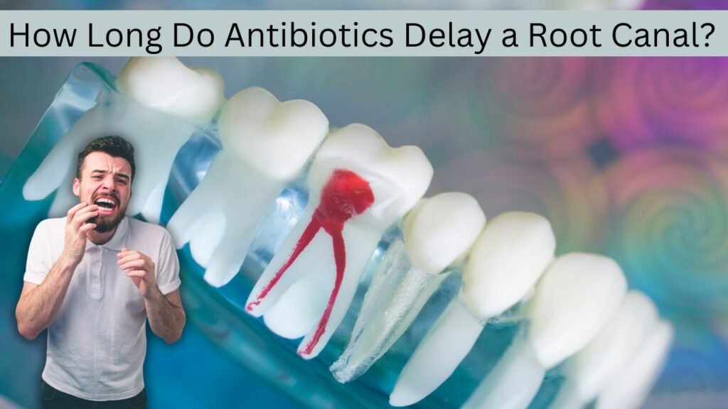 How Long Do Antibiotics Delay a Root Canal (Explained)