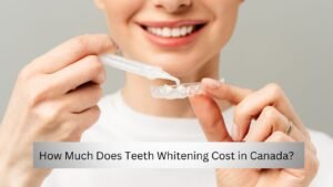How Much Does Teeth Whitening Cost in Canada?