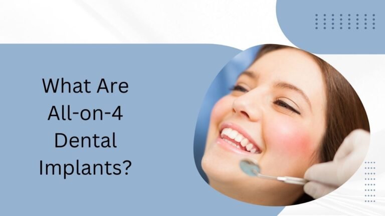 What Are All-on-4 Dental Implants