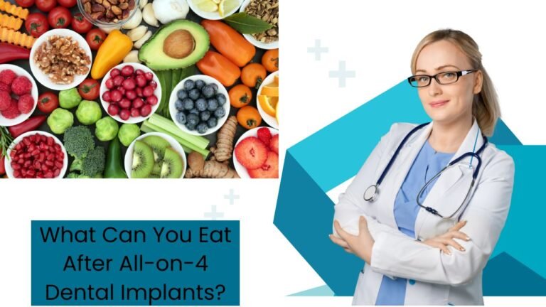 What Can You Eat After All-on-4 Dental Implants