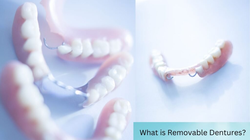 What is Removable Dentures? 1 What is Removable Dentures