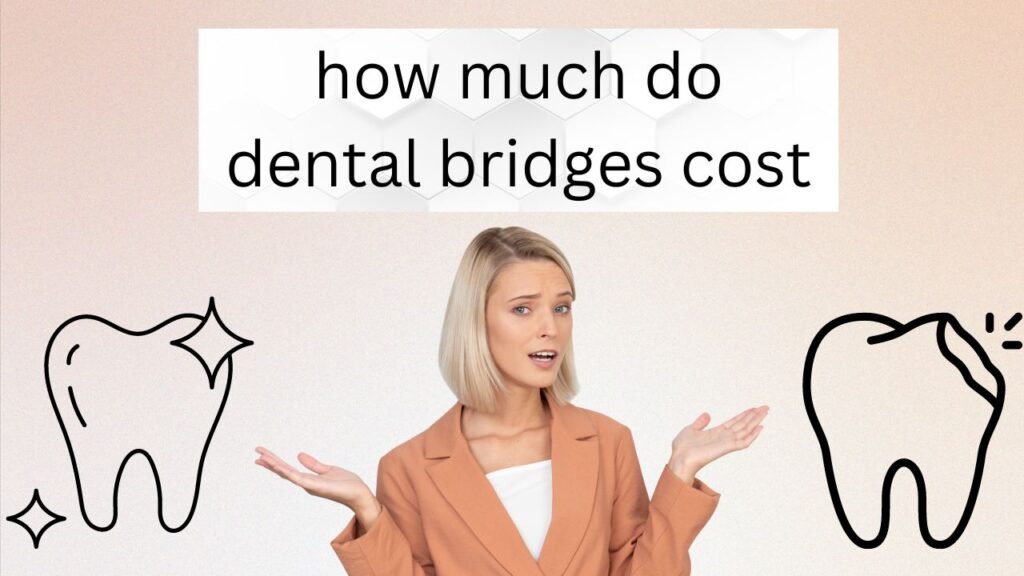 How Much do Dental Bridges Cost? 1 how much do dental bridges cost