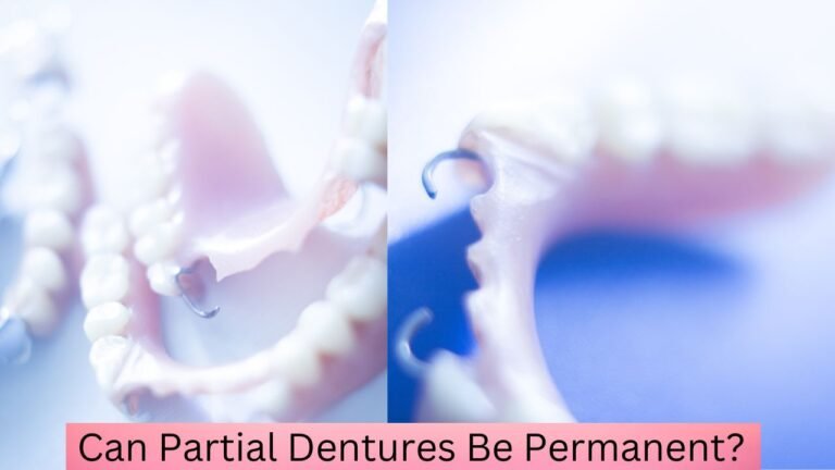Can Partial Dentures Be Permanent?
