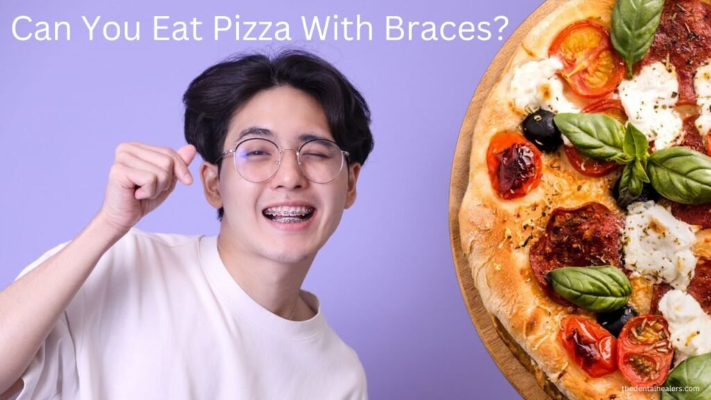 Can You Eat Pizza With Braces On The First Day