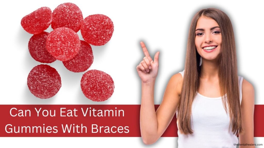 Can You Eat Vitamin Gummies With Braces