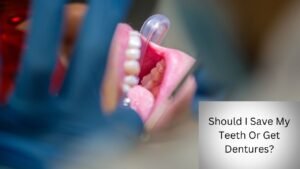 Should I Save My Teeth Or Get Dentures?