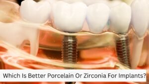 Which Is Better Porcelain Or Zirconia For Implants?
