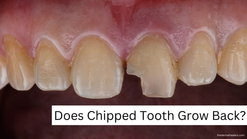 Does Chipped Tooth Grow Back