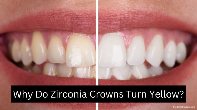 Why Do Zirconia Crowns Turn Yellow? Understanding the Causes and Solutions