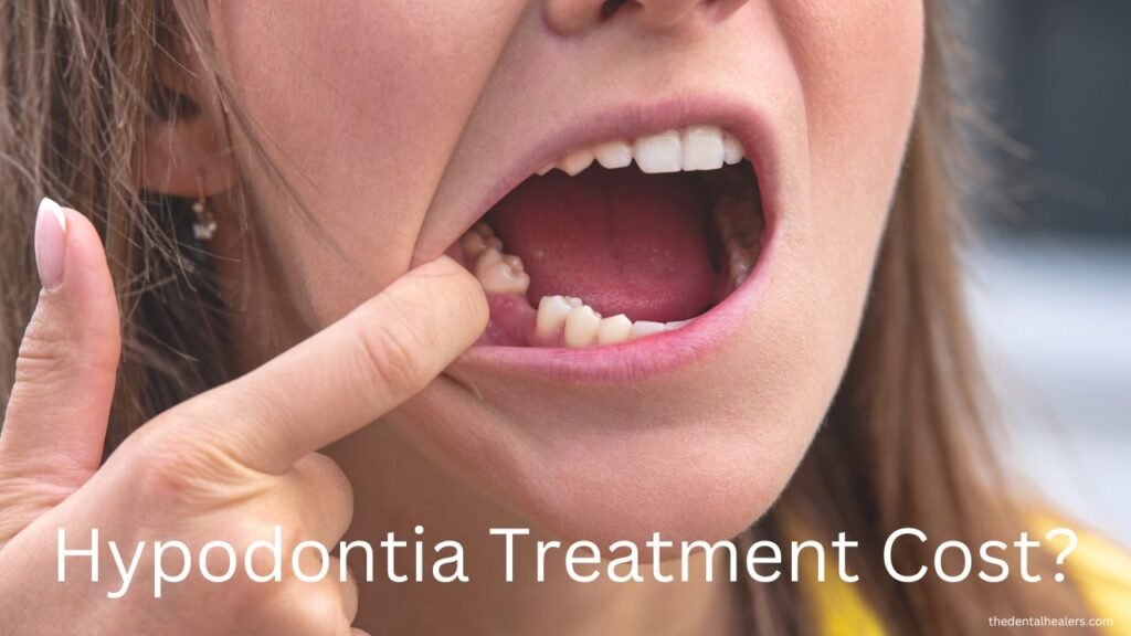 Hypodontia cost for treatment