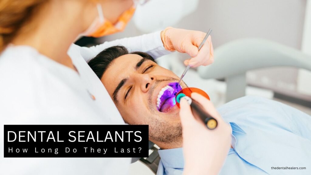 Teeth Sealants: Last How Long in the USA? Dentist Secrets Revealed!