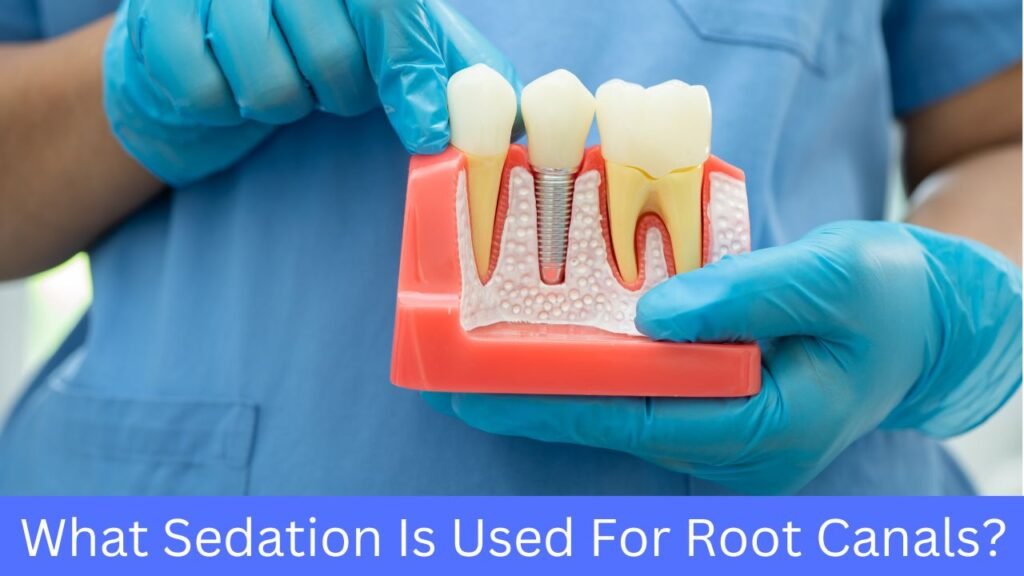 What-Sedation-Is-Used-For-Root-Canals