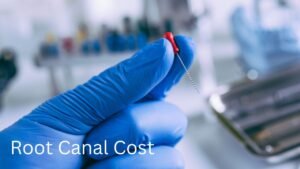 Affordable Root Canals? It's Possible! See How Much They Cost