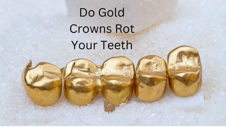 Do Gold Crowns Rot Your Teeth