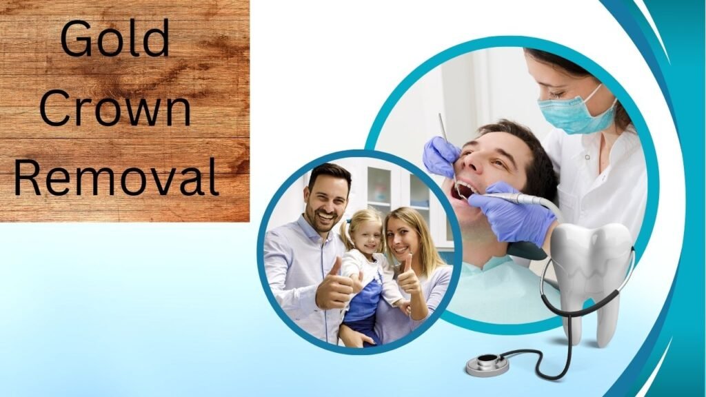 What to Expect During the Gold Crown Removal Procedure 1 Gold Crown Removal