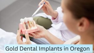 Gold Dental Implants in Oregon: A Timeless Investment for Your Smile