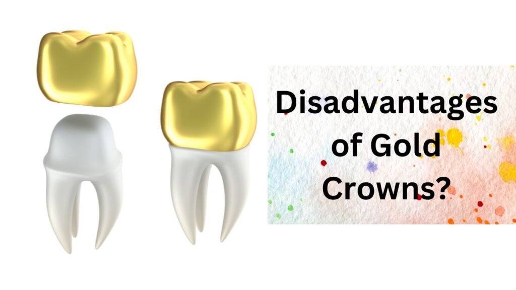 What are the Disadvantages of Gold Crowns? (Are They Really Worth It?) 1 What are the Disadvantages of Gold Crowns
