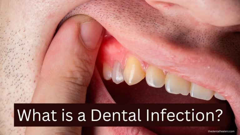 What is a Dental Infection?