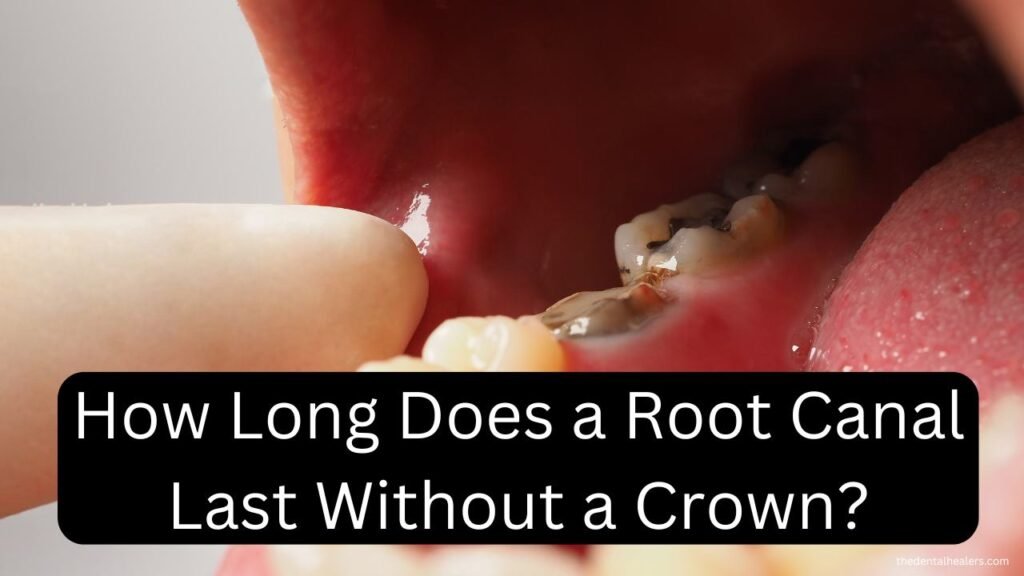 how long does a root canal last without a crown how long does a root canal last without a crown