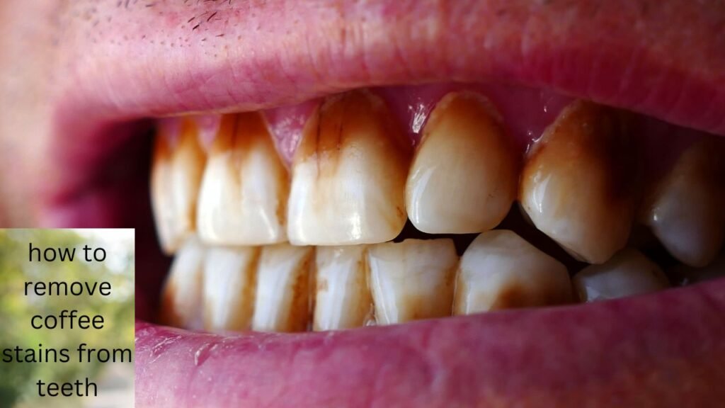 How To Remove Coffee Stains From Teeth 1 how to remove coffee stains from teeth
