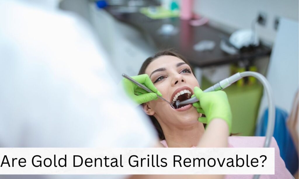 Are Gold Dental Grills Removable Are Gold Dental Grills Removable