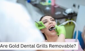 Are Gold Dental Grills Removable? The Definitive Guide to Understanding Your Options