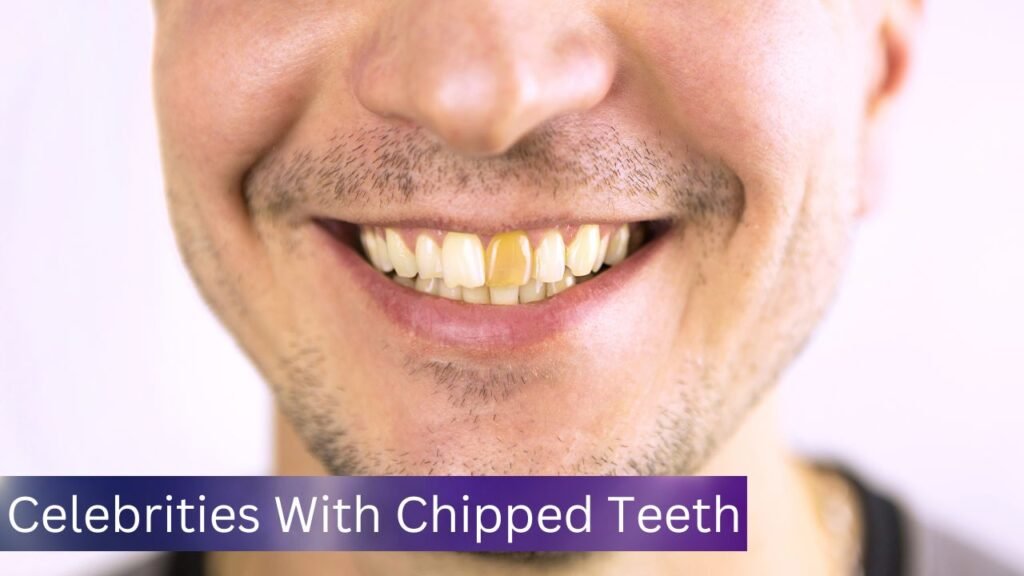 Celebrities With Chipped Teeth Celebrities With Chipped Teeth