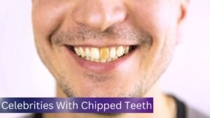 Celebrities with Chipped Teeth: Fascinating Stories and Essential Dental Tips