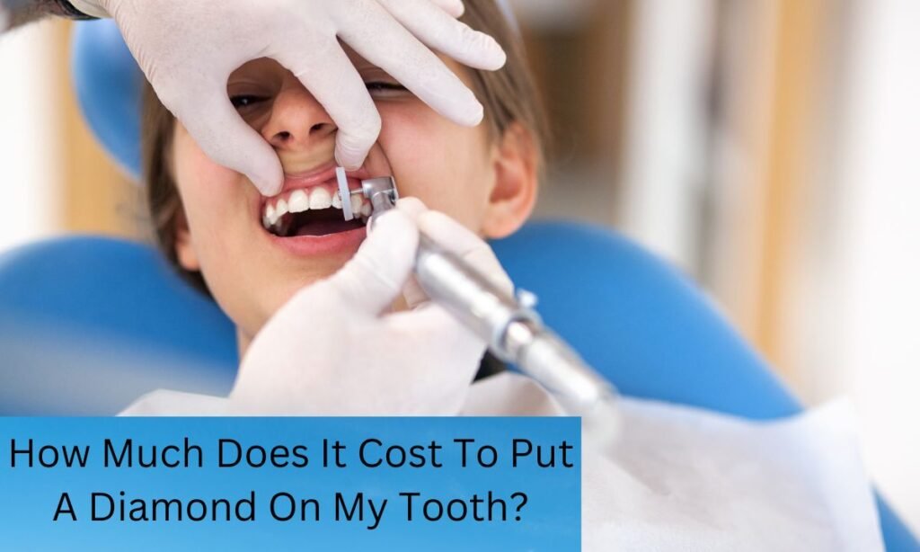 How Much Does It Cost To Put A Diamond On My Tooth How Much Does It Cost To Put A Diamond On My Tooth