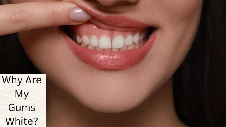 Why Are My Gums White? Understanding Causes, Solutions, and When to Seek Help