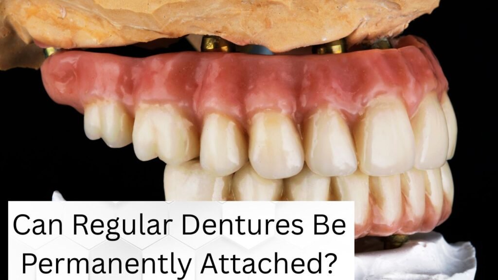 Can Regular Dentures Be Permanently Attached Can Regular Dentures Be Permanently Attached?