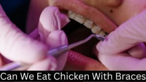 Can We Eat Chicken With Braces