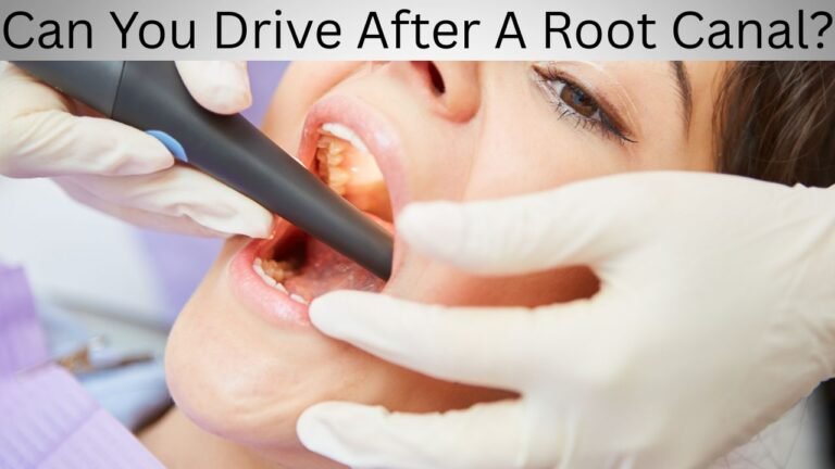 Can You Drive After A Root Canal?