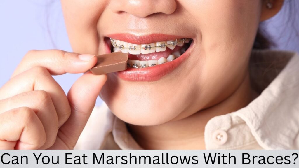 Can You Eat Marshmallows With Braces Can You Eat Marshmallows With Braces?