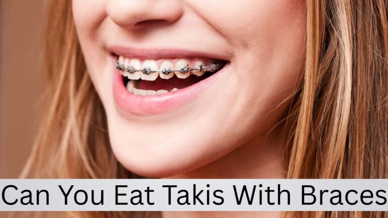 Can You Eat Takis With Braces