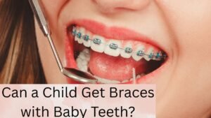Can a Child Get Braces with Baby Teeth?