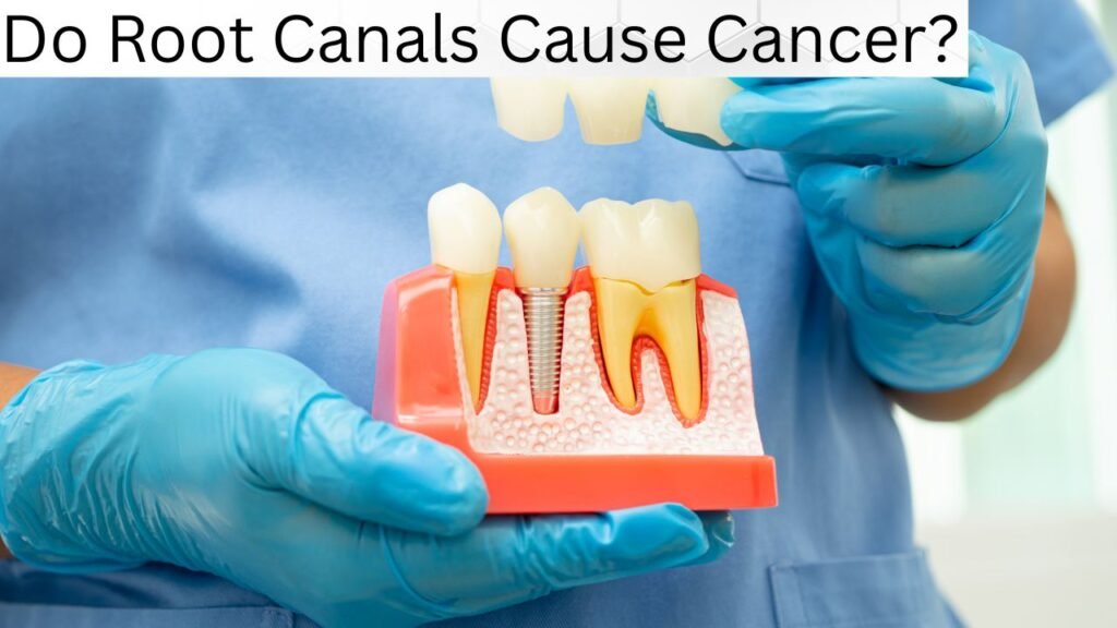 Do Root Canals Cause Cancer Do Root Canals Cause Cancer?