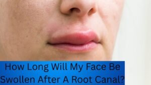 How Long Will My Face Be Swollen After A Root Canal?