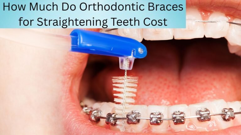 How Much Do Orthodontic Braces for Straightening Teeth Cost in the USA? Find Out Here!