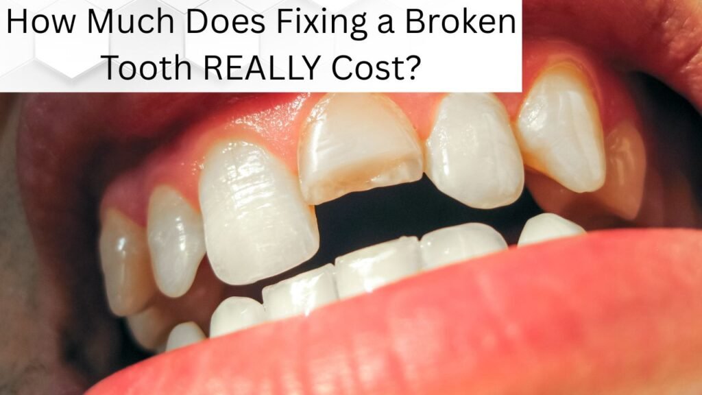 How Much Does Fixing a Broken Tooth REALLY Cost How Much Does Fixing a Broken Tooth REALLY Cost?