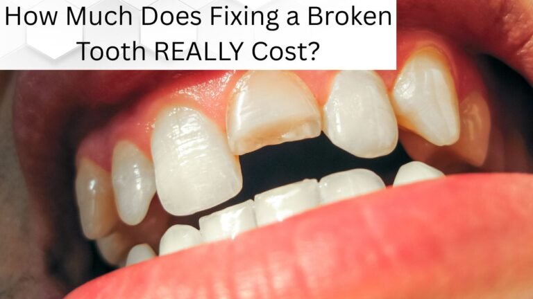 How Much Does Fixing a Broken Tooth REALLY Cost? (Dental Trauma Costs in the USA)