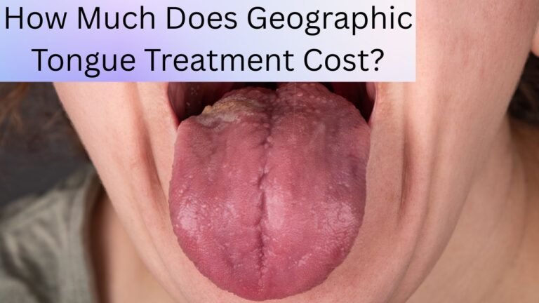 How Much Does Geographic Tongue Treatment Cost?
