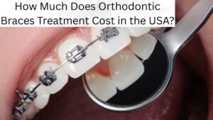How Much Does Orthodontic Braces Treatment Cost in the USA?​