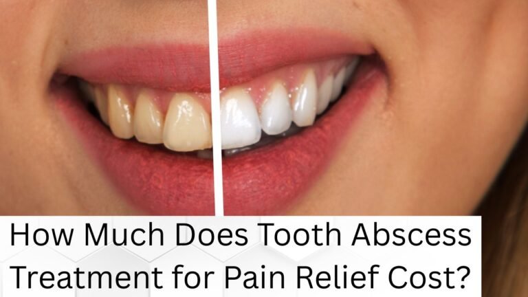 How Much Does Tooth Abscess Treatment for Pain Relief Cost?