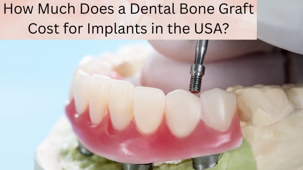 How Much Does a Dental Bone Graft Cost for Implants in the USA How Much Does a Dental Bone Graft Cost for Implants in the USA?