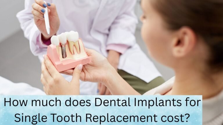 How much does Dental Implants for Single Tooth Replacement cost?