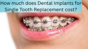 How much does Orthodontic Braces for Misaligned Teeth cost?