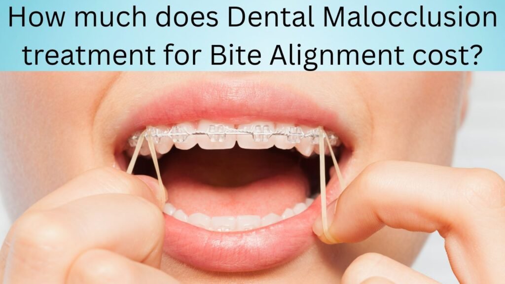 How much does Dental Malocclusion treatment for Bite Alignment cost How much does Dental Malocclusion treatment for Bite Alignment cost?